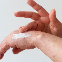 Fluocinolone Acetonide Cream