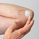 Anti-Itch Skin Cream